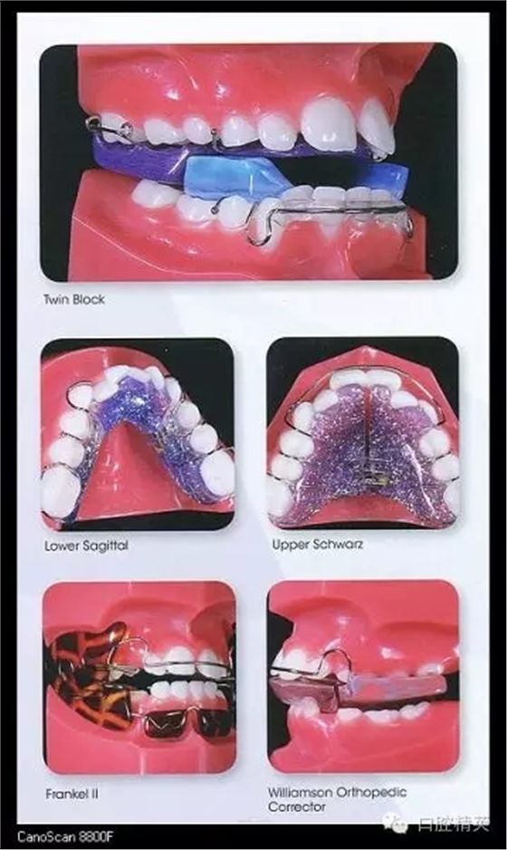 解決牙齒不齊的十八般武器 解決牙齒不齊的十八般武器