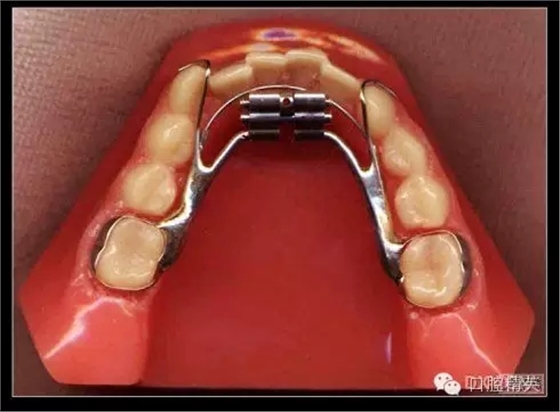 解決牙齒不齊的十八般武器 解決牙齒不齊的十八般武器