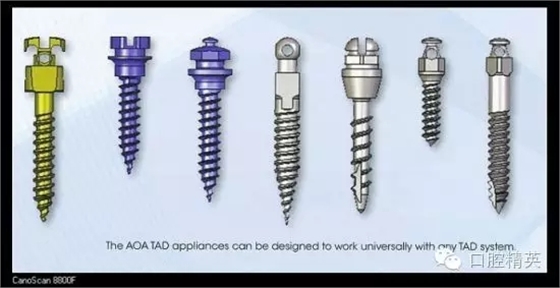 解決牙齒不齊的十八般武器 解決牙齒不齊的十八般武器