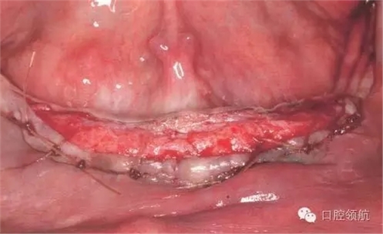 5.webp.jpg 5.webp.jpg