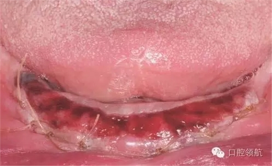 6.webp.jpg 6.webp.jpg