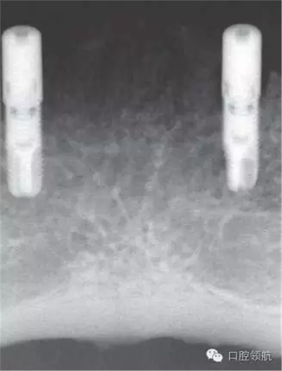 10.webp.jpg 10.webp.jpg