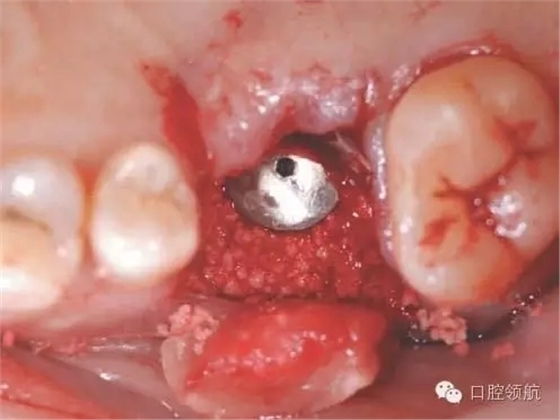 6.webp.jpg 6.webp.jpg