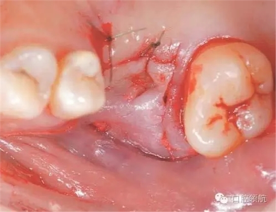 7.webp.jpg 7.webp.jpg