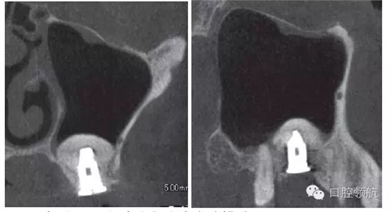 8.webp.jpg 8.webp.jpg