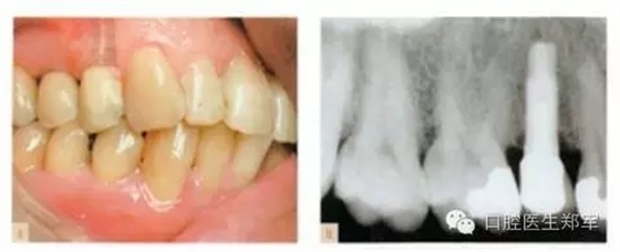 1.webp.jpg 1.webp.jpg