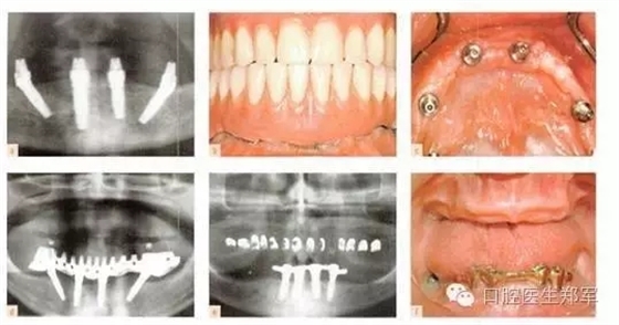 3.webp.jpg 3.webp.jpg