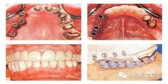 11.webp.jpg 11.webp.jpg