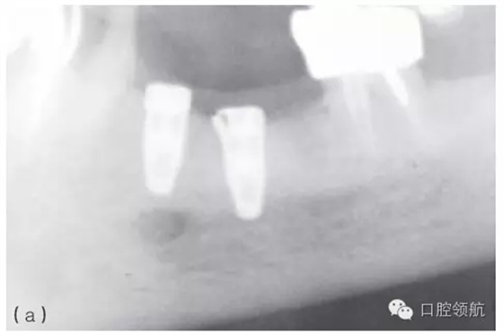 2.webp.jpg 2.webp.jpg