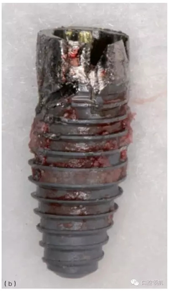 3.webp.jpg 3.webp.jpg