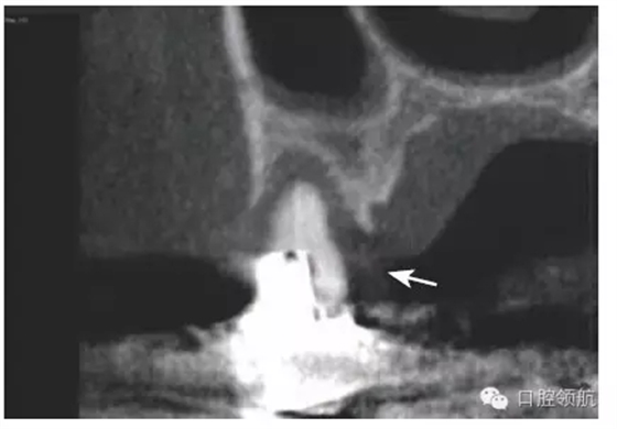 4.webp.jpg 4.webp.jpg