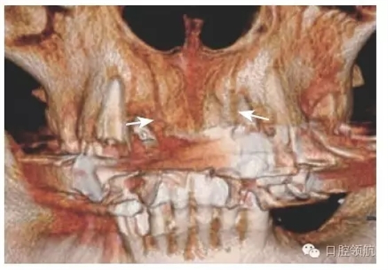 5.webp.jpg 5.webp.jpg