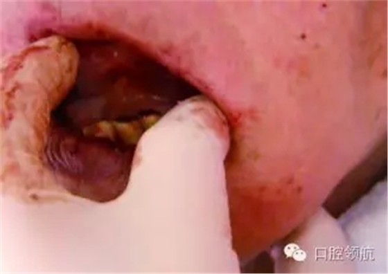 6.webp.jpg 6.webp.jpg