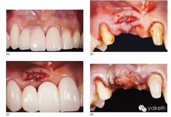 11.webp.jpg 11.webp.jpg