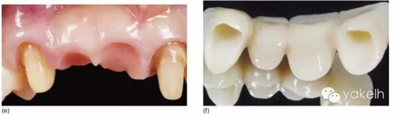 12.webp.jpg 12.webp.jpg