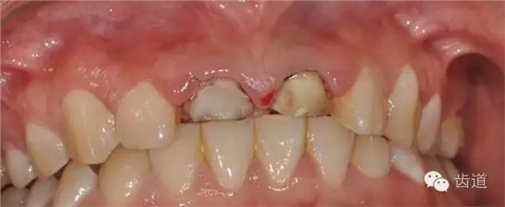 5.webp.jpg 5.webp.jpg