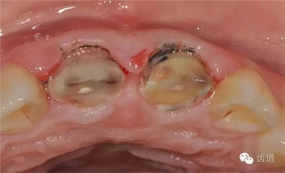 6.webp.jpg 6.webp.jpg