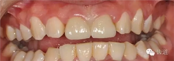 11.webp.jpg 11.webp.jpg