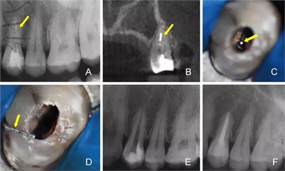8.webp.jpg 8.webp.jpg