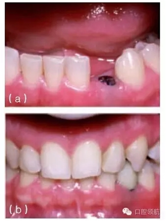 9.webp.jpg 9.webp.jpg