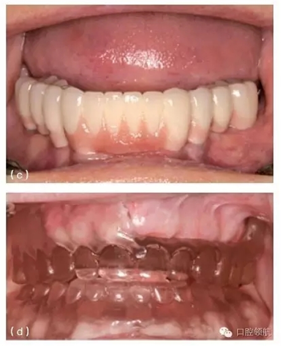 20.webp.jpg 20.webp.jpg