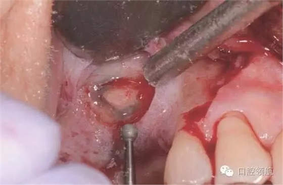 4.webp.jpg 4.webp.jpg