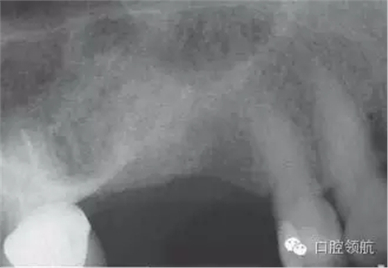 10.webp.jpg 10.webp.jpg