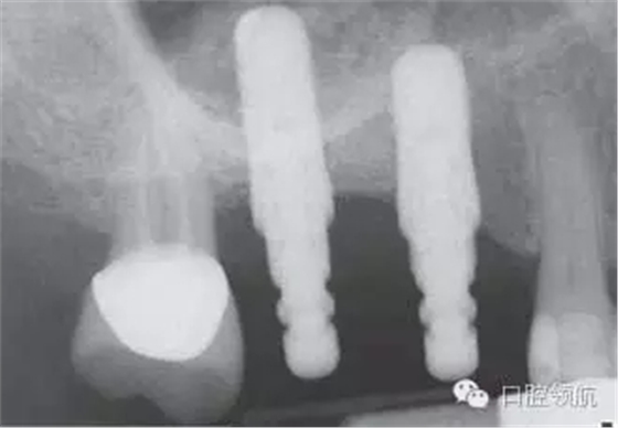 11.webp.jpg 11.webp.jpg