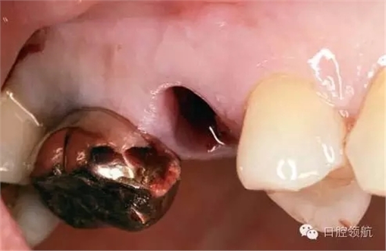 3.webp.jpg 3.webp.jpg