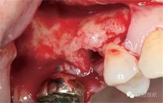 4.webp.jpg 4.webp.jpg