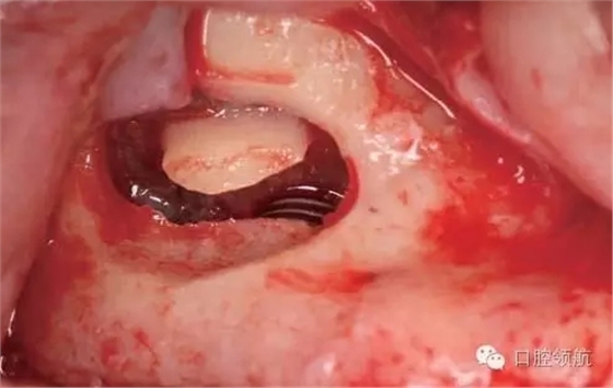 5.webp.jpg 5.webp.jpg