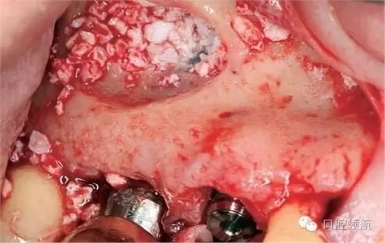 6.webp.jpg 6.webp.jpg