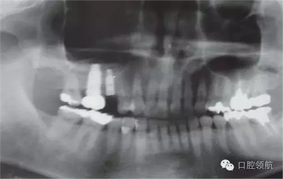 8.webp.jpg 8.webp.jpg