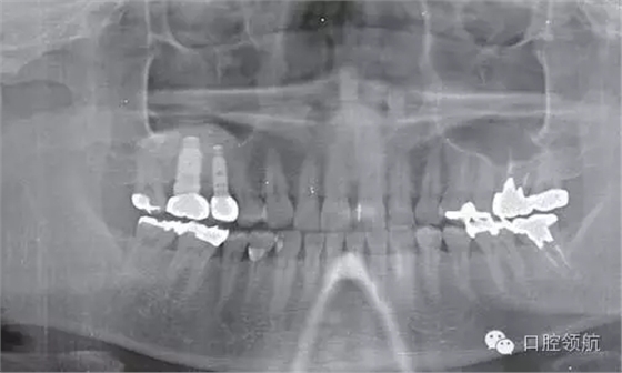 10.webp.jpg 10.webp.jpg