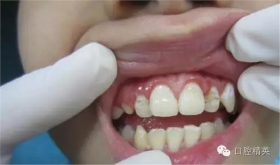 1.webp.jpg 1.webp.jpg