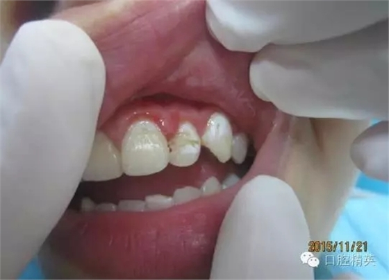 2.webp.jpg 2.webp.jpg