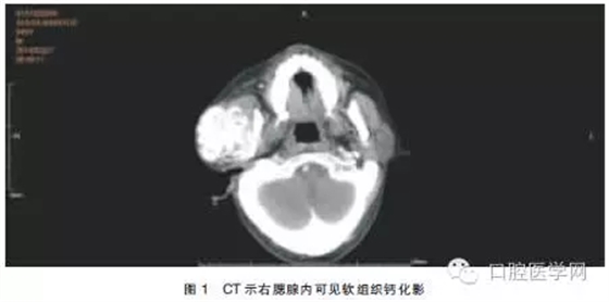 4.webp.jpg 4.webp.jpg