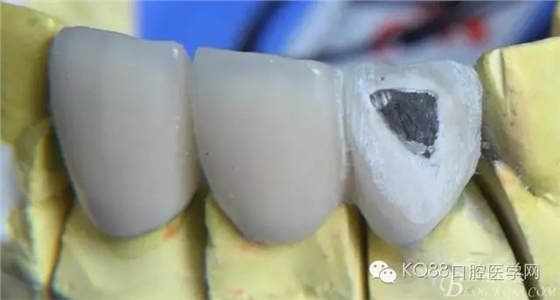 5.webp.jpg 5.webp.jpg