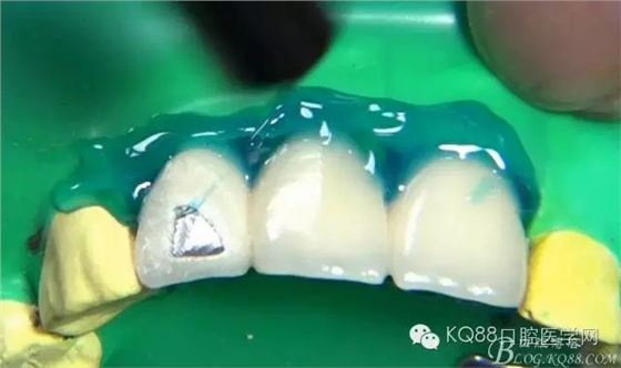 10.webp.jpg 10.webp.jpg