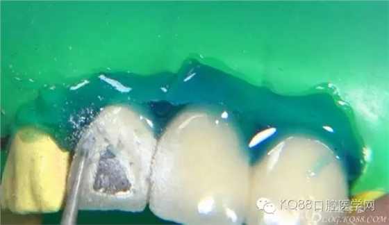 12.webp.jpg 12.webp.jpg