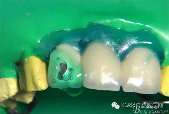 15.webp.jpg 15.webp.jpg