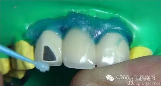 17.webp.jpg 17.webp.jpg