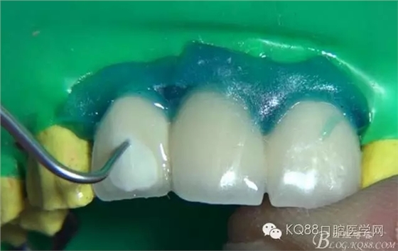 20.webp.jpg 20.webp.jpg