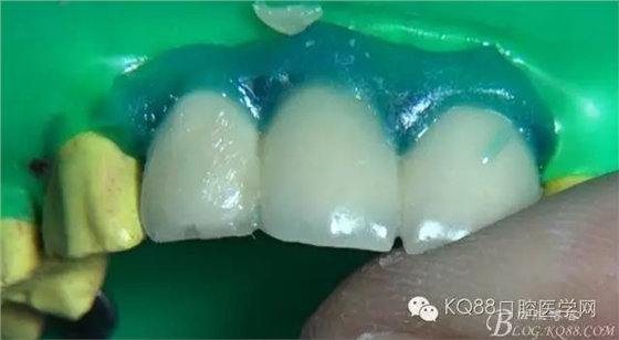 22.webp.jpg 22.webp.jpg