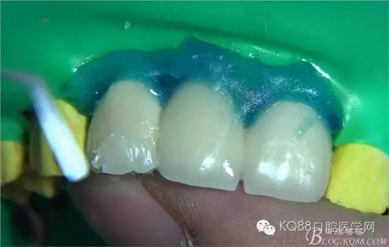 23.webp.jpg 23.webp.jpg