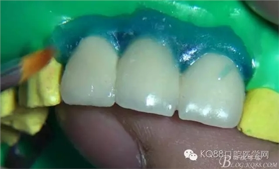 24.webp.jpg 24.webp.jpg