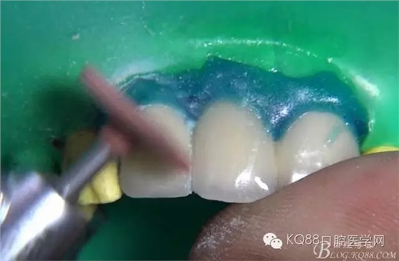 29.webp.jpg 29.webp.jpg