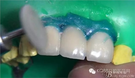 30.webp.jpg 30.webp.jpg