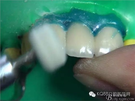 31.webp.jpg 31.webp.jpg