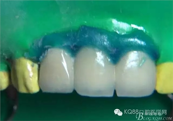 32.webp.jpg 32.webp.jpg